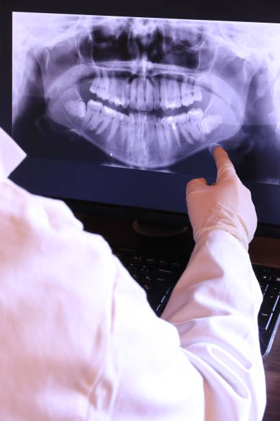 Best Emergency Tooth Extraction in Ottawa, KS